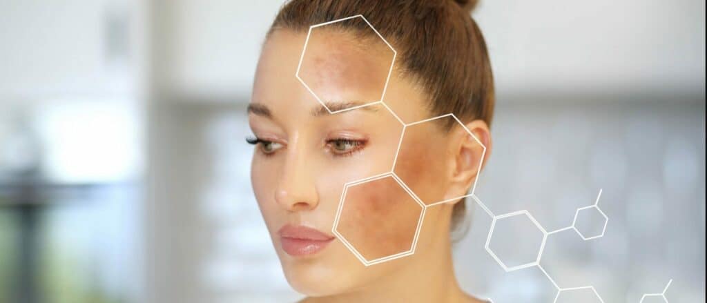 Clear Face Female with Hexagon Face Describing Dull Skin | Medbeautiq in Boca Raton, FL