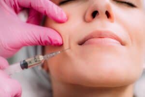 Dermal Filler Injection for Nasolabial Folds | Medbeautiq in Boca Raton, FL