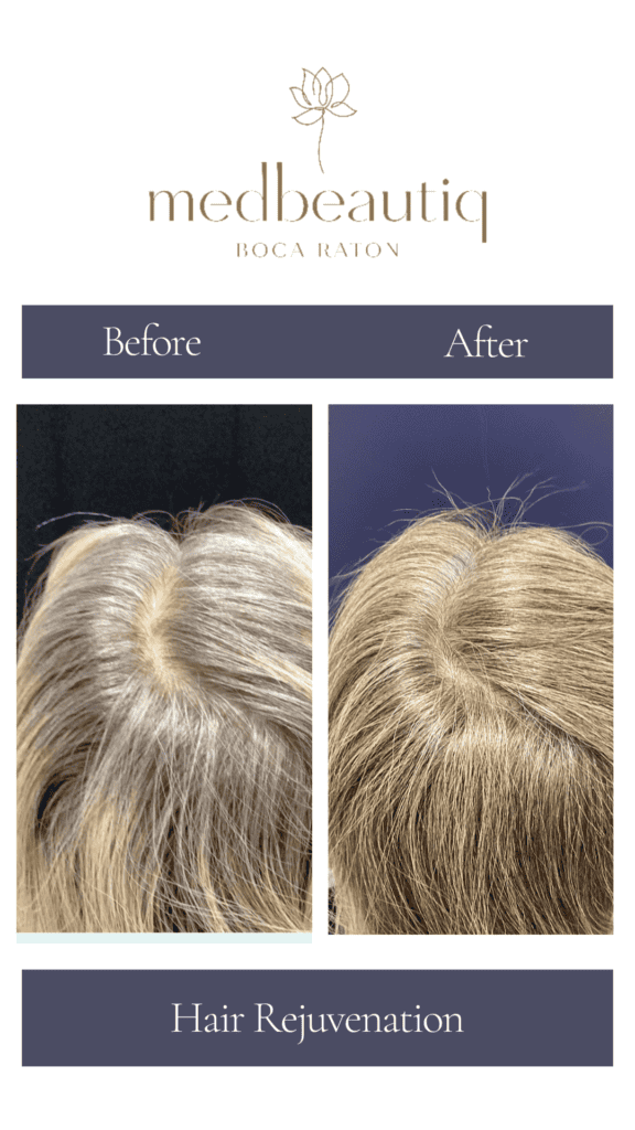 Cópia de Cópia de Cópia de Cópia de Neutral Before and After Instagram Post (Instagram Story) (6)