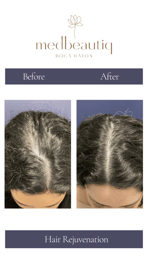 Female,44, hair loss treatment - stories (2)