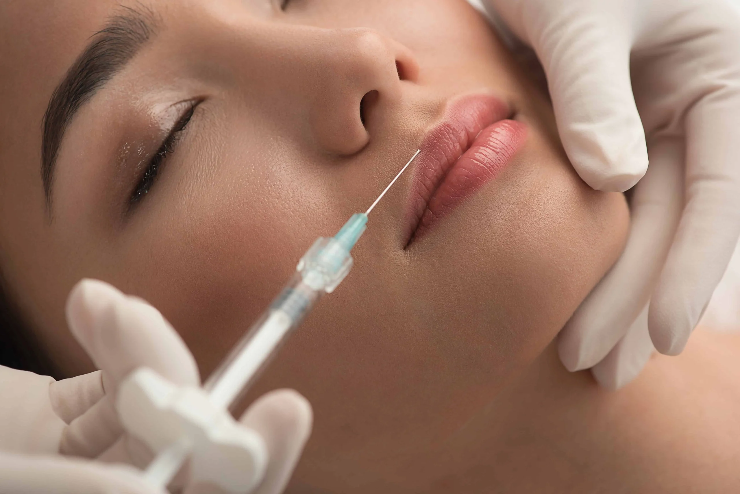 Restylane® Filler