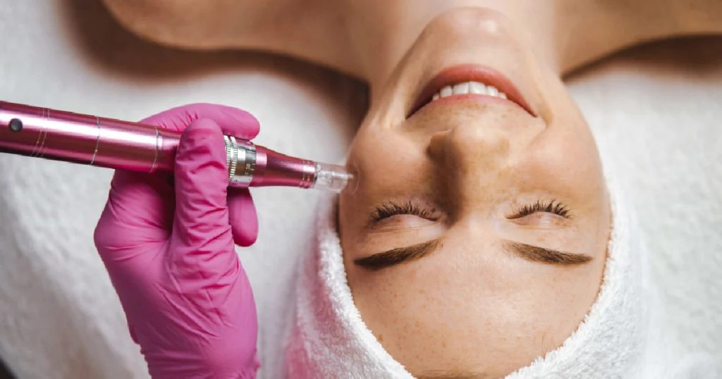 Woman wearing a towel headband receives facial mesoneedling in Boca Raton, FL
