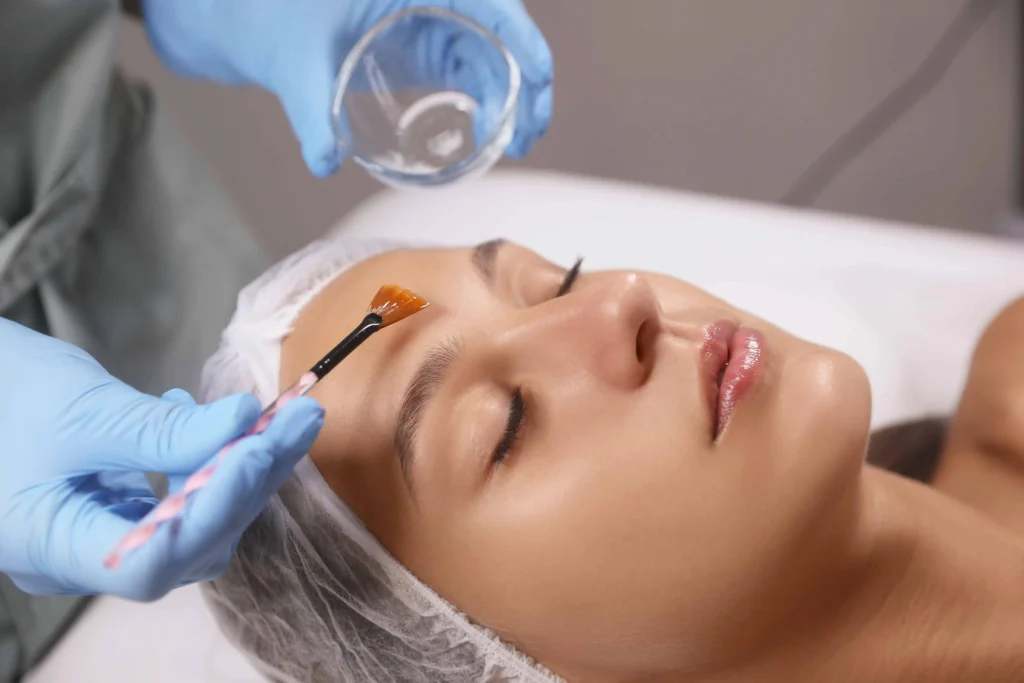 Woman receiving chemical peel treatment for smooth glowing skin
