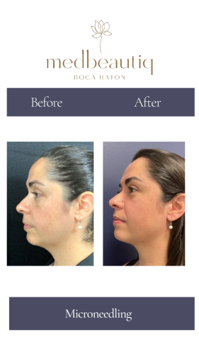 Cópia de Cópia de Cópia de Cópia de Cópia de Neutral Before and After Instagram Post (Instagram Story) (4)