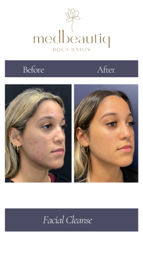 Cópia de Cópia de Cópia de Cópia de Neutral Before and After Instagram Post (Instagram Story) (10)