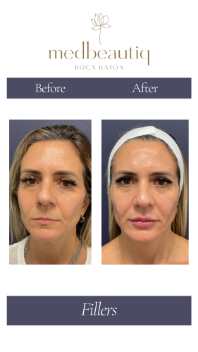 Cópia de Cópia de Cópia de Neutral Before and After Instagram Post (Instagram Story) (3)