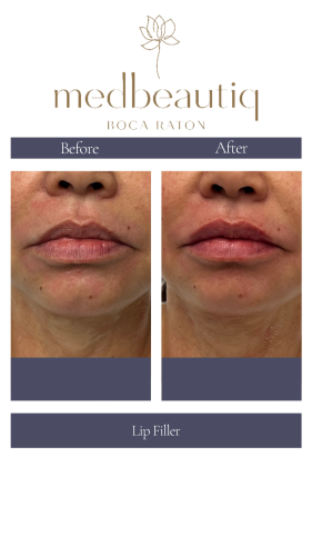 Copy of boca leticia