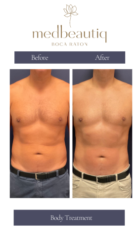 Male, 51, body treatment Stories (1)