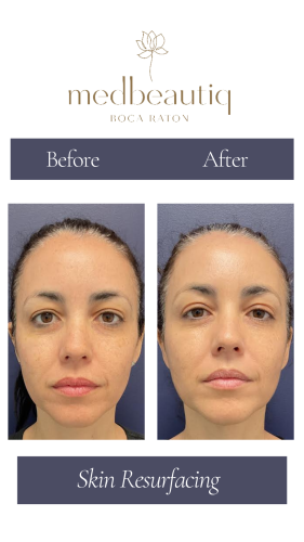 Neutral Before and After Instagram Post (Instagram Story) (1)