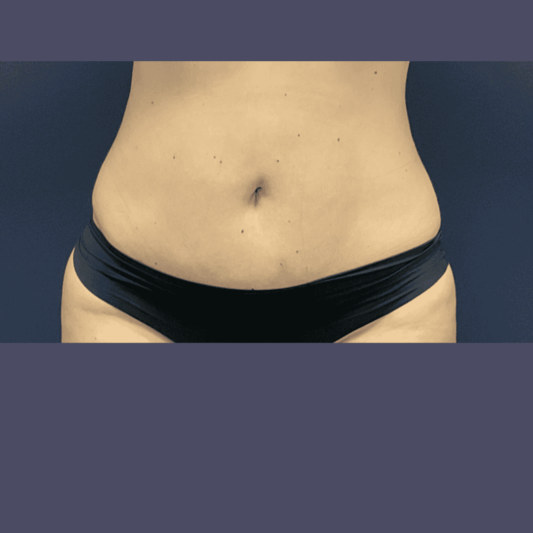 Before and after gallery