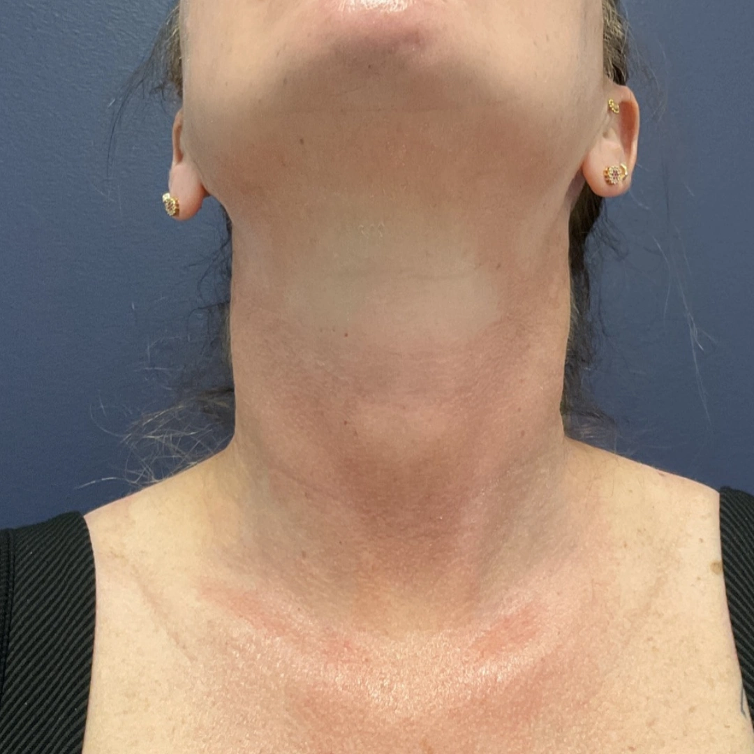 Before and after gallery