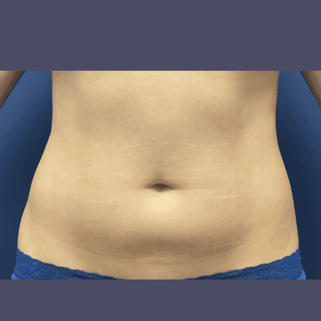 Before and after gallery