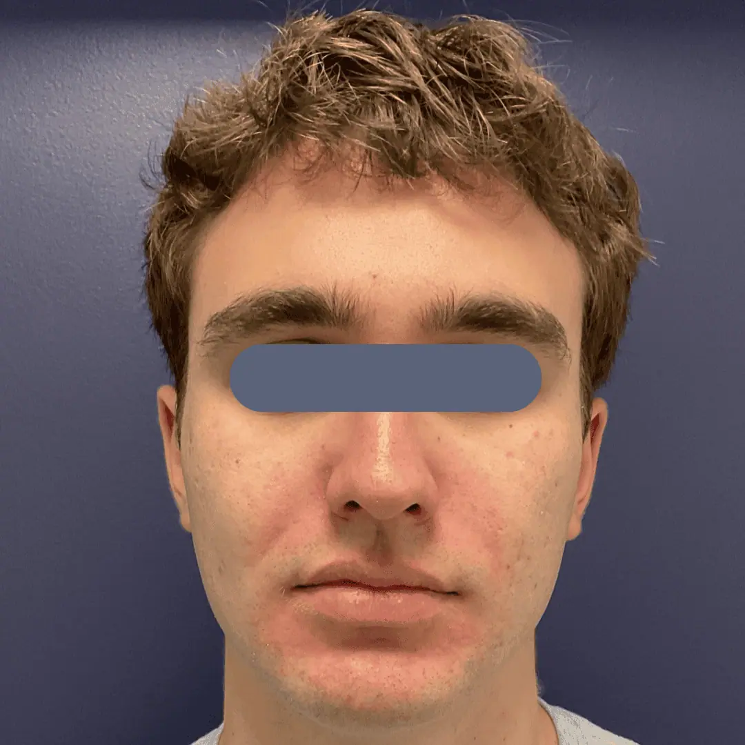 Before and after gallery