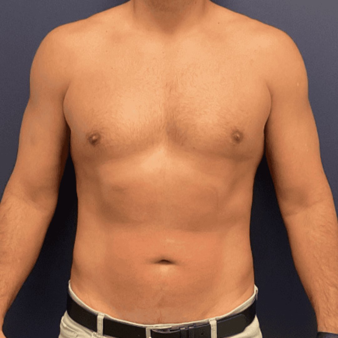 Before and after gallery