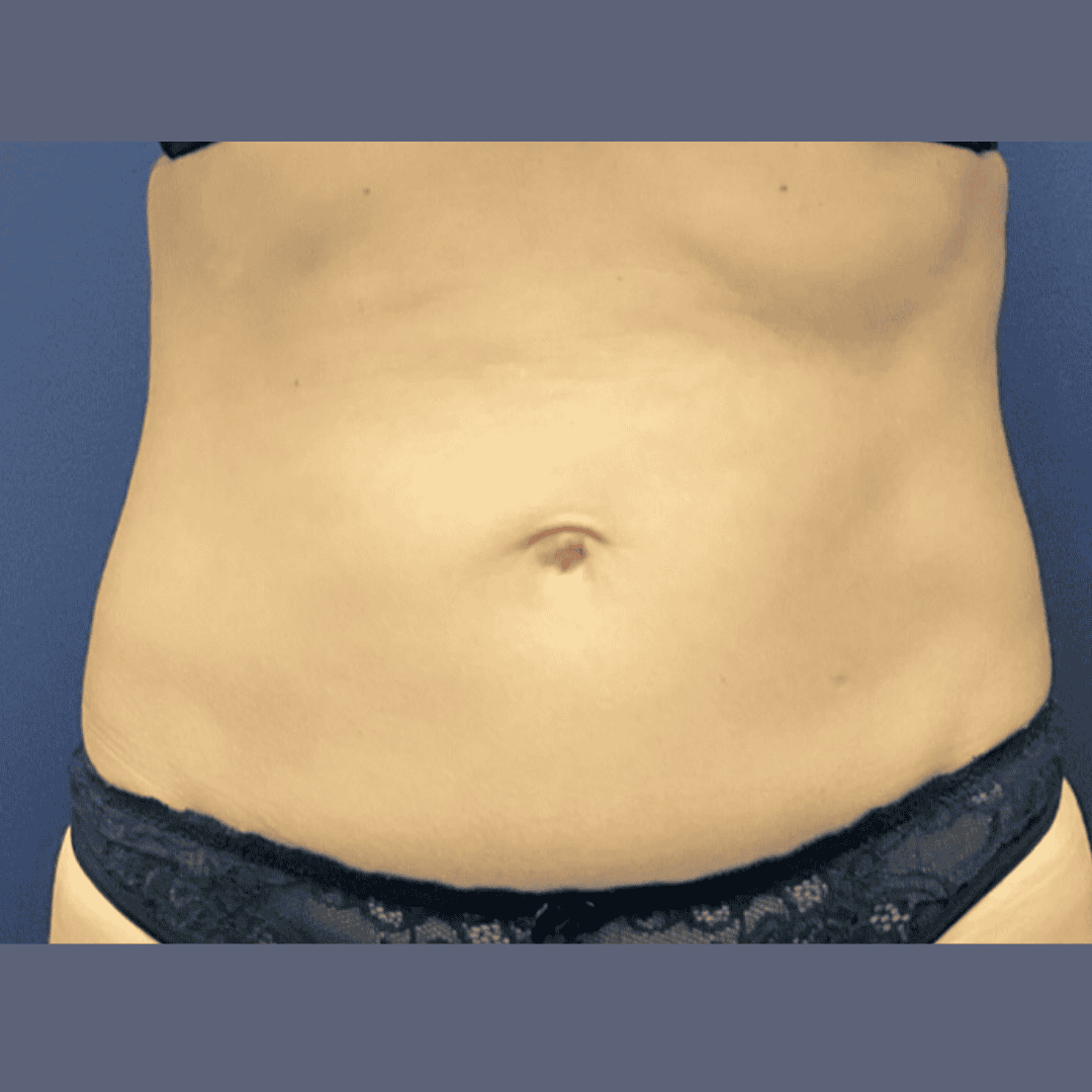 Before and after gallery