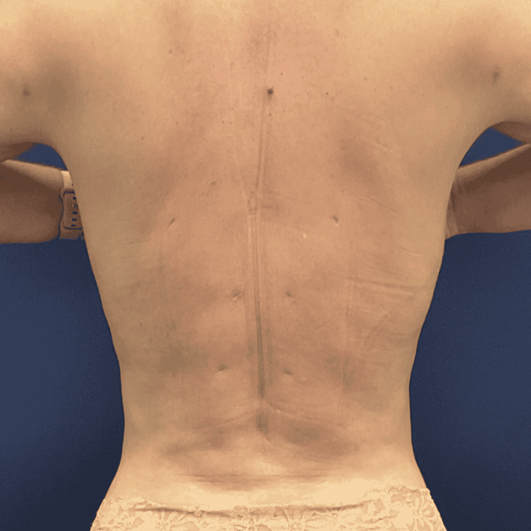 Before and after gallery