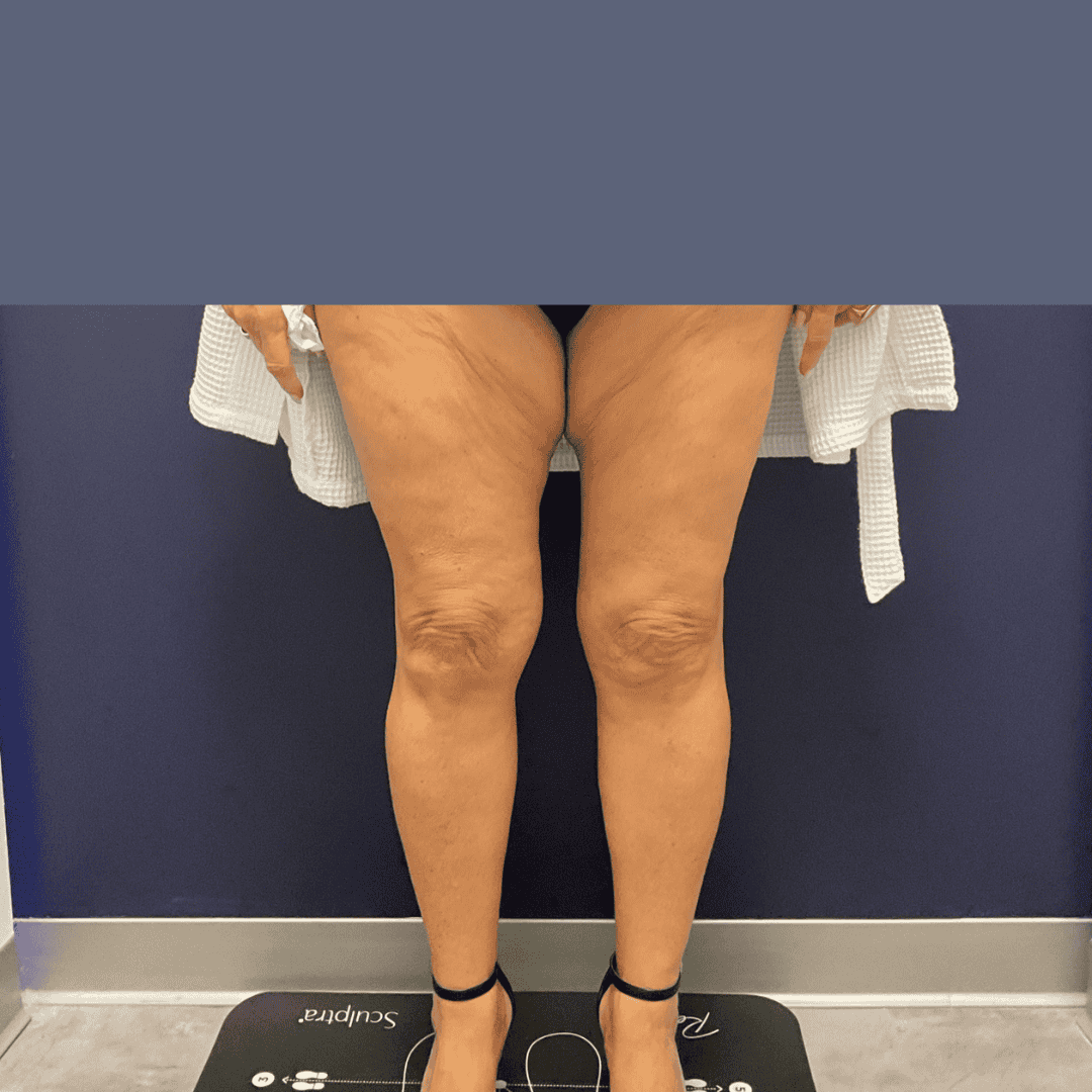 Before and after gallery