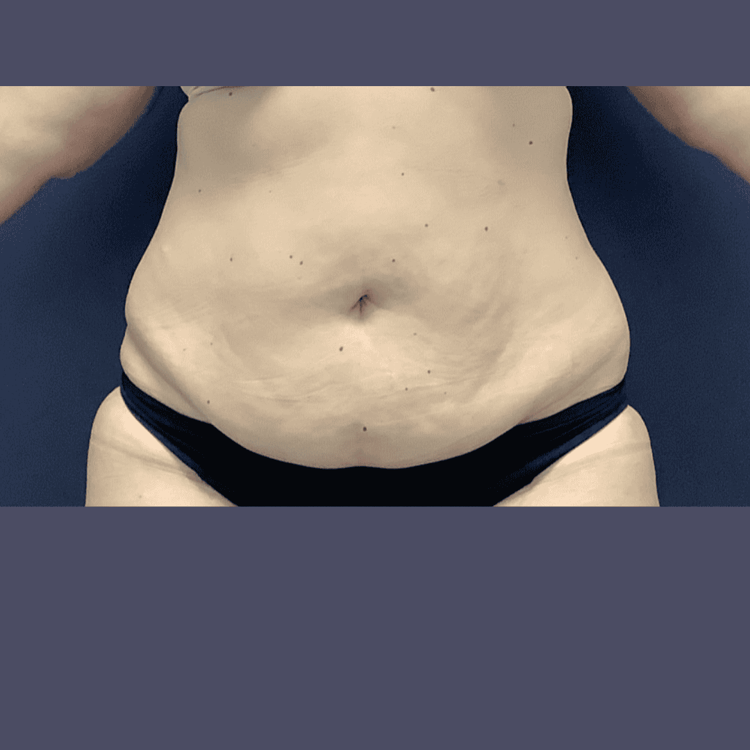 Before and after gallery