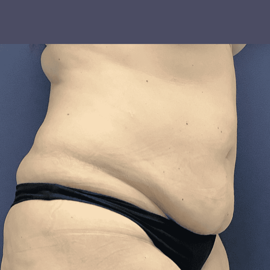 Before and after gallery