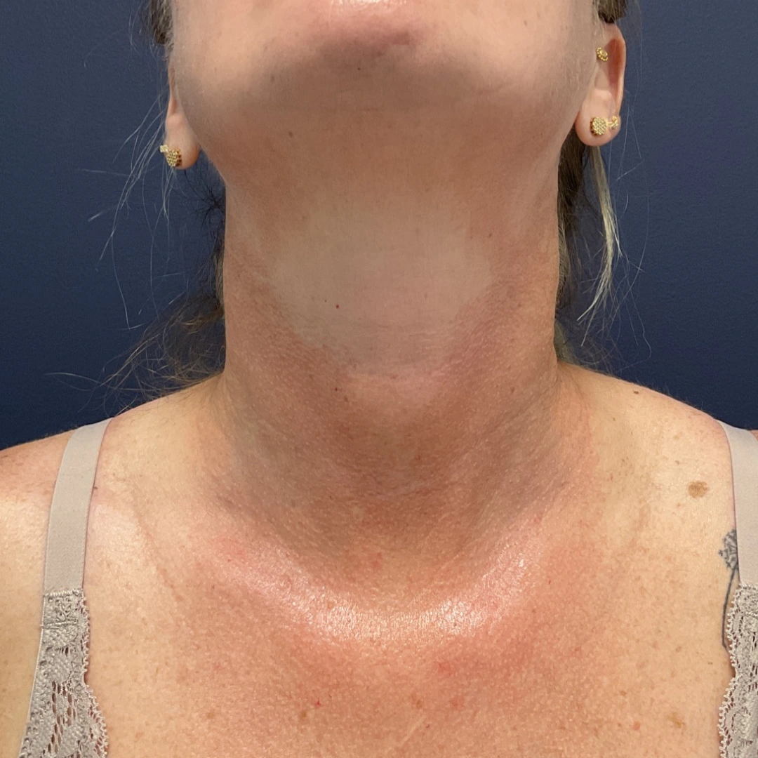 Before and after gallery