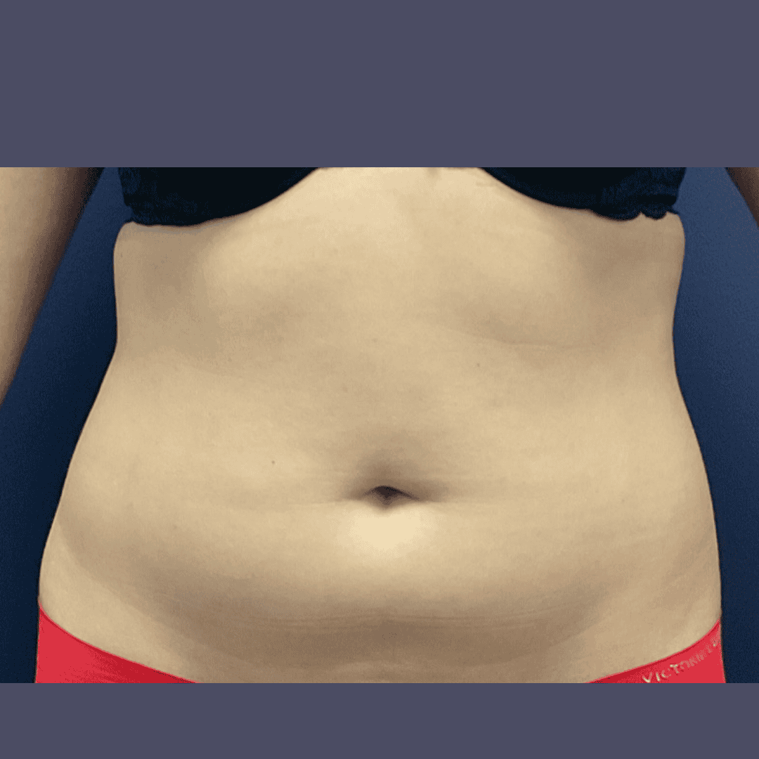 Before and after gallery