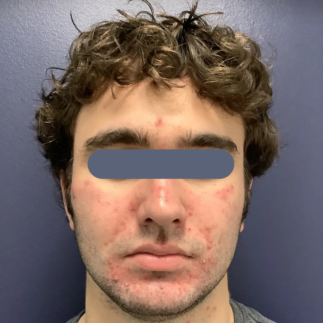 Before and after gallery