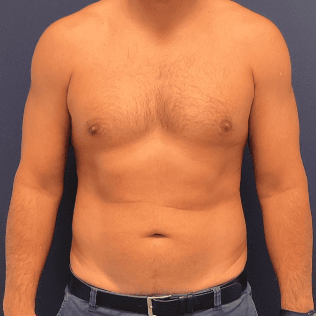 Before and after gallery