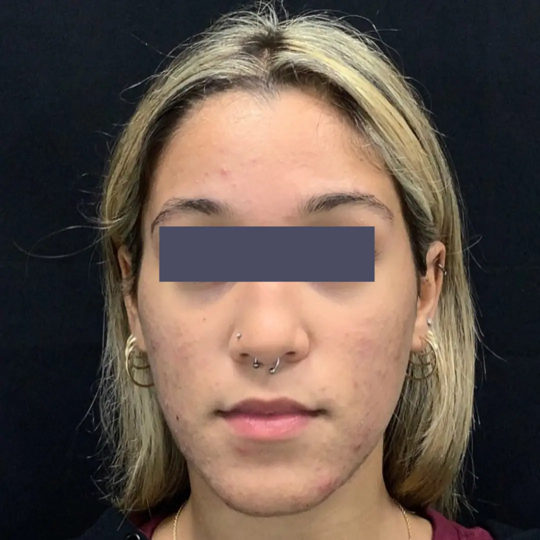 Before and after gallery