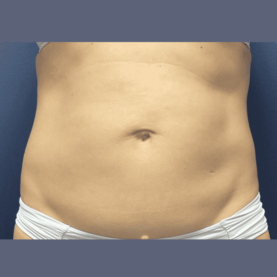 Before and after gallery