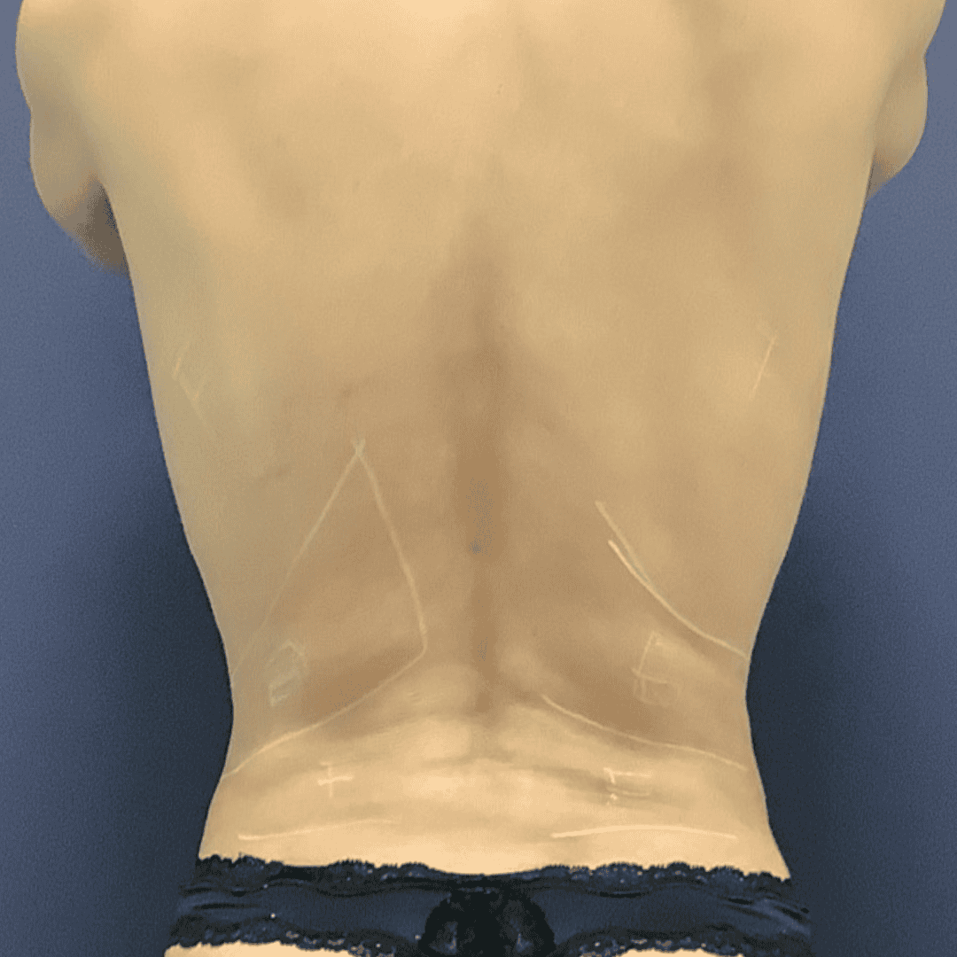 Before and after gallery