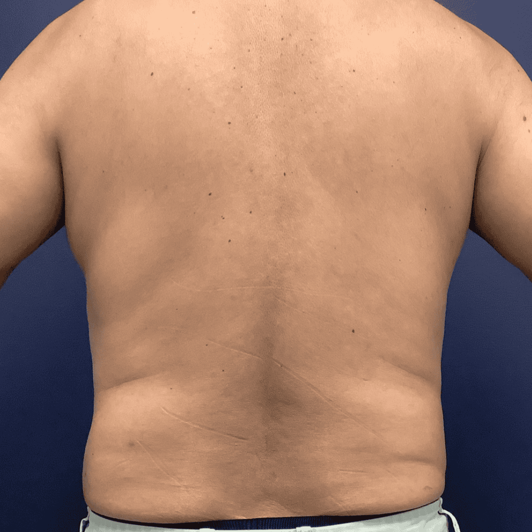 Before and after gallery