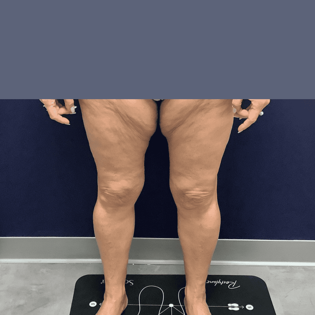 Before and after gallery